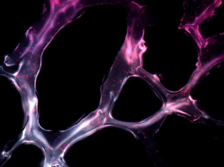 Imágenes-HD-cáncer